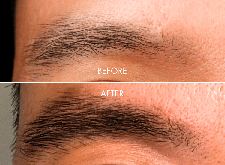 IBROW-Product_Page_2_b29ade05-d424-42f8-a880-e93f0e07ca44.png