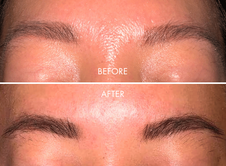 IBROW-Product_Page_4.png