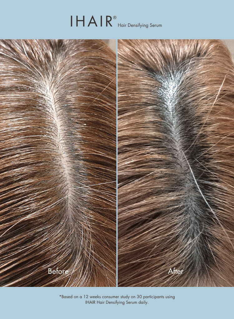 IHAIR Hair Densifying Serum